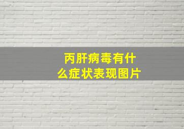 丙肝病毒有什么症状表现图片