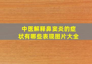 中医解释鼻窦炎的症状有哪些表现图片大全