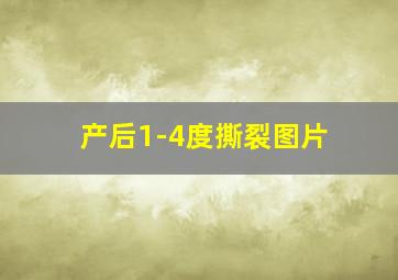 产后1-4度撕裂图片