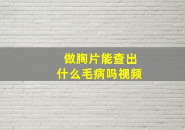 做胸片能查出什么毛病吗视频