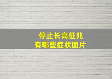 停止长高征兆有哪些症状图片