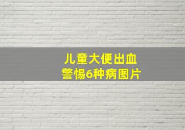 儿童大便出血警惕6种病图片