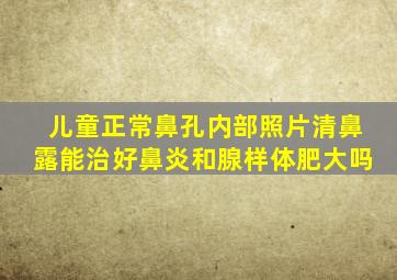 儿童正常鼻孔内部照片清鼻露能治好鼻炎和腺样体肥大吗