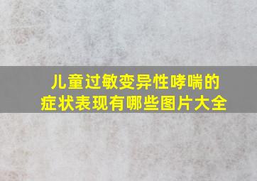 儿童过敏变异性哮喘的症状表现有哪些图片大全