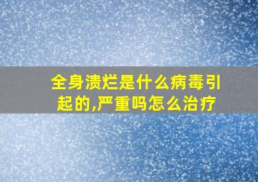 全身溃烂是什么病毒引起的,严重吗怎么治疗