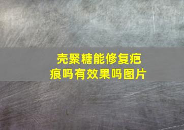 壳聚糖能修复疤痕吗有效果吗图片