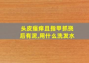 头皮瘙痒且指甲抓挠后有泥,用什么洗发水