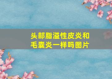 头部脂溢性皮炎和毛囊炎一样吗图片