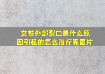 女性外部裂口是什么原因引起的怎么治疗呢图片