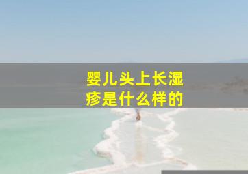 婴儿头上长湿疹是什么样的