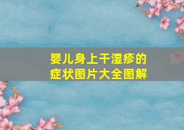 婴儿身上干湿疹的症状图片大全图解