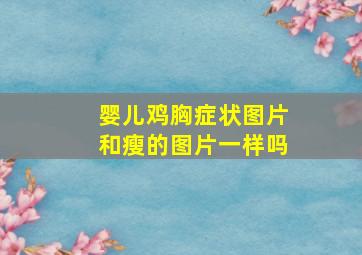 婴儿鸡胸症状图片和瘦的图片一样吗