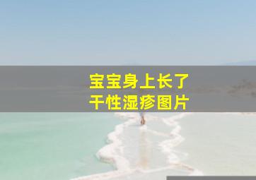 宝宝身上长了干性湿疹图片