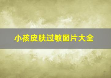 小孩皮肤过敏图片大全