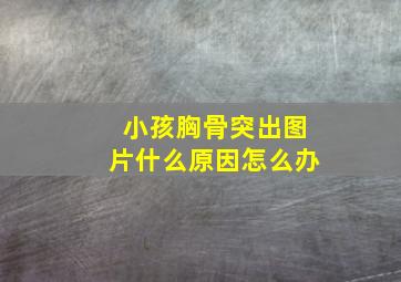 小孩胸骨突出图片什么原因怎么办