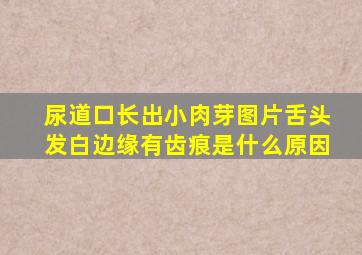 尿道口长出小肉芽图片舌头发白边缘有齿痕是什么原因