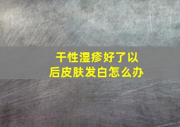 干性湿疹好了以后皮肤发白怎么办