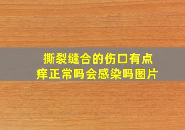 撕裂缝合的伤口有点痒正常吗会感染吗图片