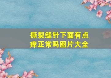 撕裂缝针下面有点痒正常吗图片大全