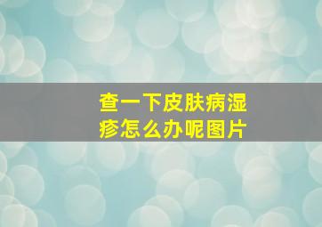 查一下皮肤病湿疹怎么办呢图片