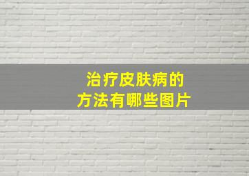 治疗皮肤病的方法有哪些图片