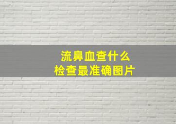 流鼻血查什么检查最准确图片