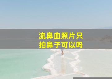 流鼻血照片只拍鼻子可以吗