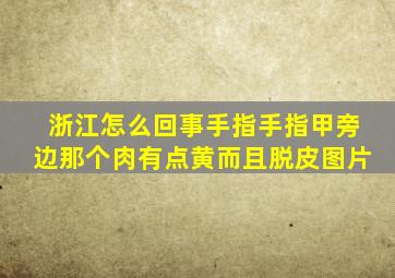 浙江怎么回事手指手指甲旁边那个肉有点黄而且脱皮图片