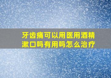 牙齿痛可以用医用酒精漱口吗有用吗怎么治疗