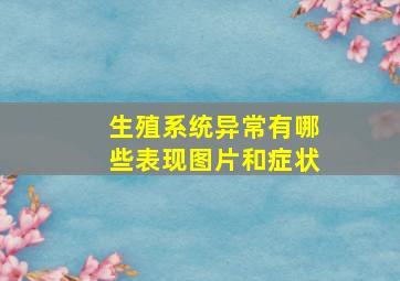 生殖系统异常有哪些表现图片和症状