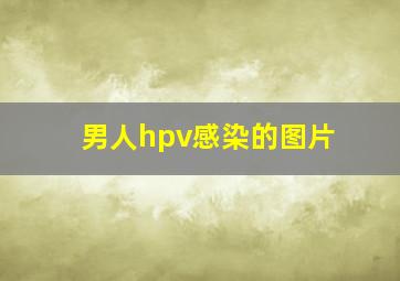 男人hpv感染的图片