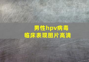 男性hpv病毒临床表现图片高清