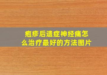 疱疹后遗症神经痛怎么治疗最好的方法图片