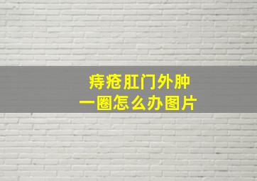 痔疮肛门外肿一圈怎么办图片