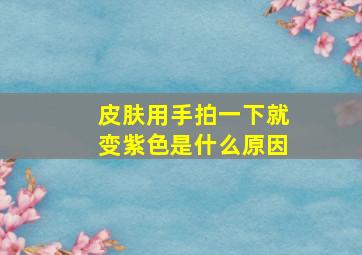 皮肤用手拍一下就变紫色是什么原因