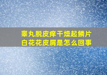 睾丸脱皮痒干燥起鳞片白花花皮屑是怎么回事