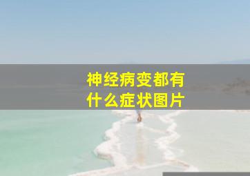 神经病变都有什么症状图片