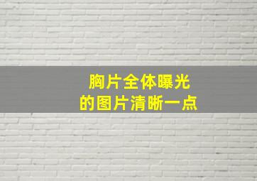 胸片全体曝光的图片清晰一点