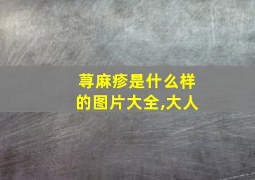 荨麻疹是什么样的图片大全,大人