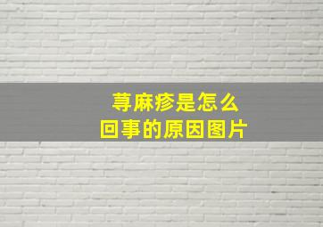 荨麻疹是怎么回事的原因图片