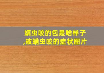 螨虫咬的包是啥样子,被螨虫咬的症状图片