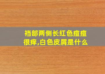 裆部两侧长红色痘痘很痒,白色皮屑是什么