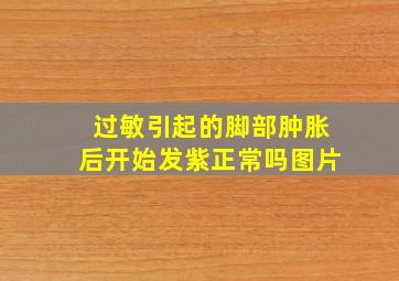 过敏引起的脚部肿胀后开始发紫正常吗图片