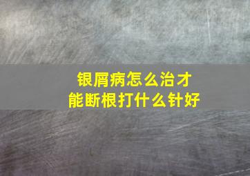 银屑病怎么治才能断根打什么针好