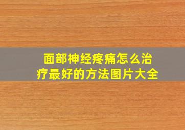 面部神经疼痛怎么治疗最好的方法图片大全