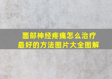 面部神经疼痛怎么治疗最好的方法图片大全图解