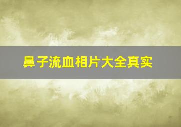 鼻子流血相片大全真实