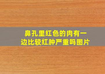 鼻孔里红色的肉有一边比较红肿严重吗图片