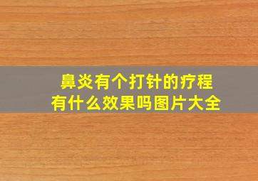 鼻炎有个打针的疗程有什么效果吗图片大全